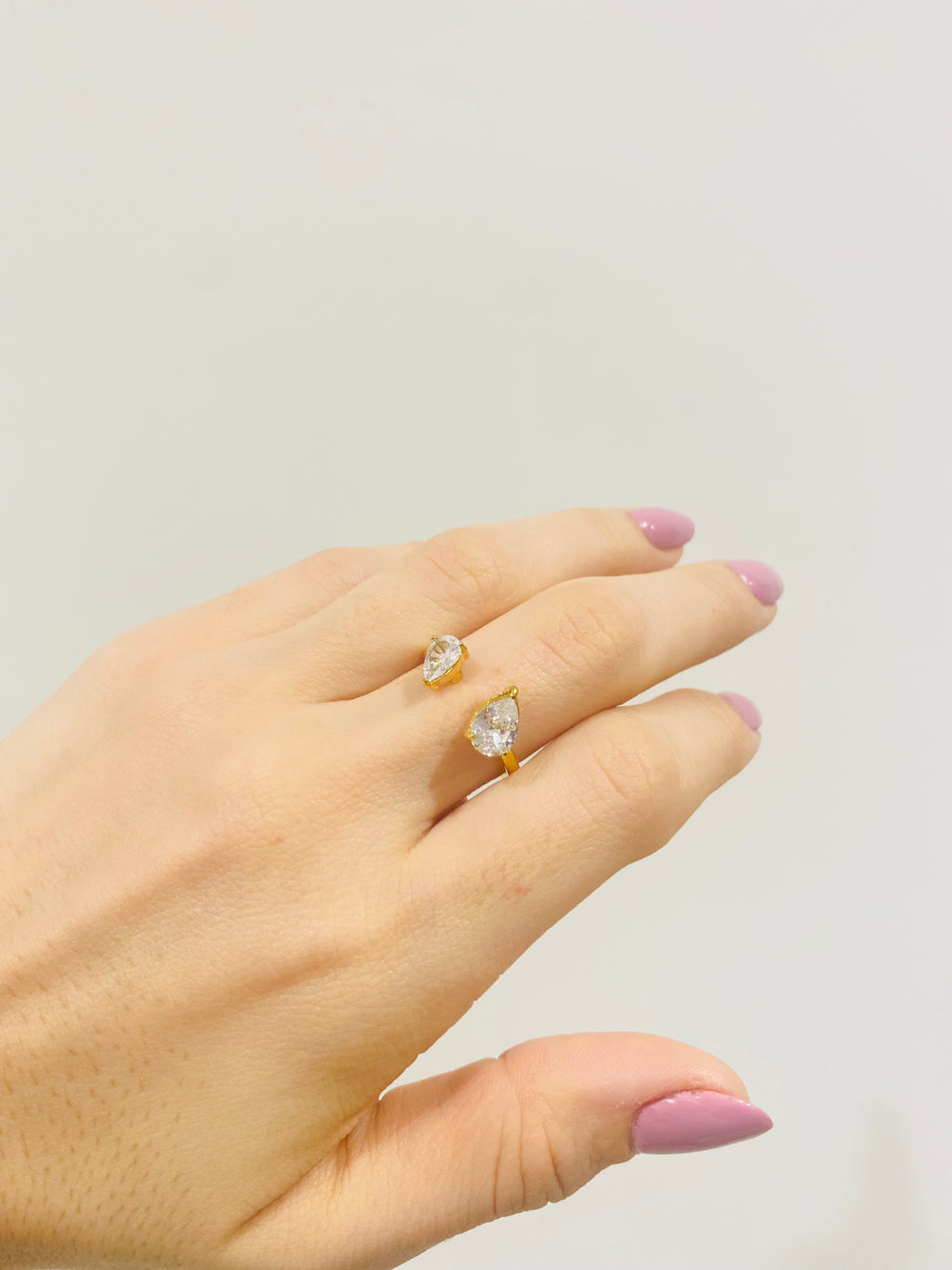 Anello Miranda